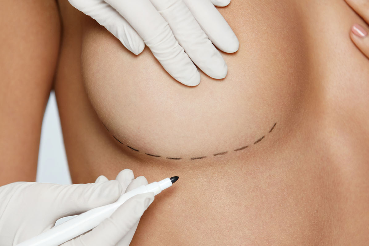 Breast