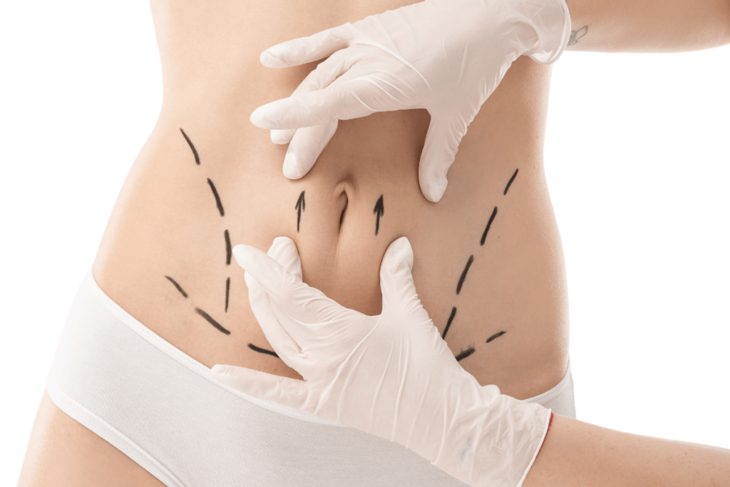 Body Contouring Procedure