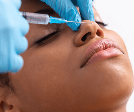 Dermal Fillers