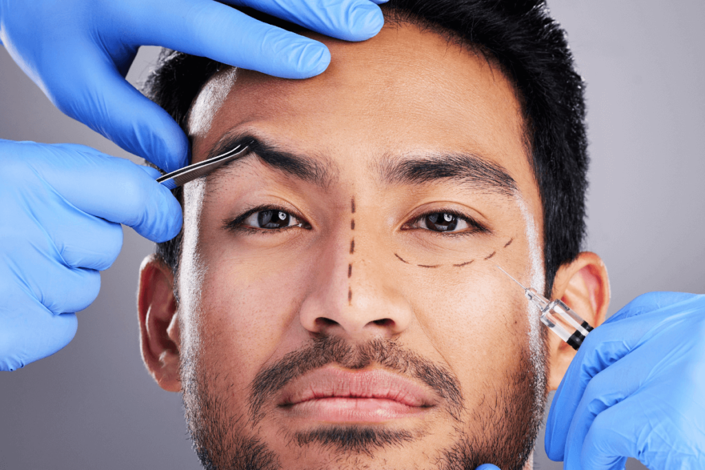 Brow Lift_2