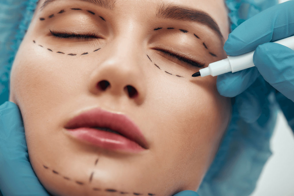 Eye Lift