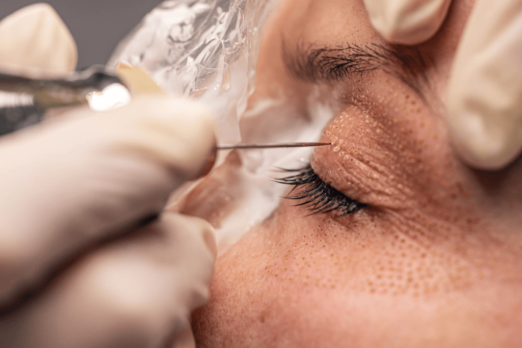 Eye Lift_2