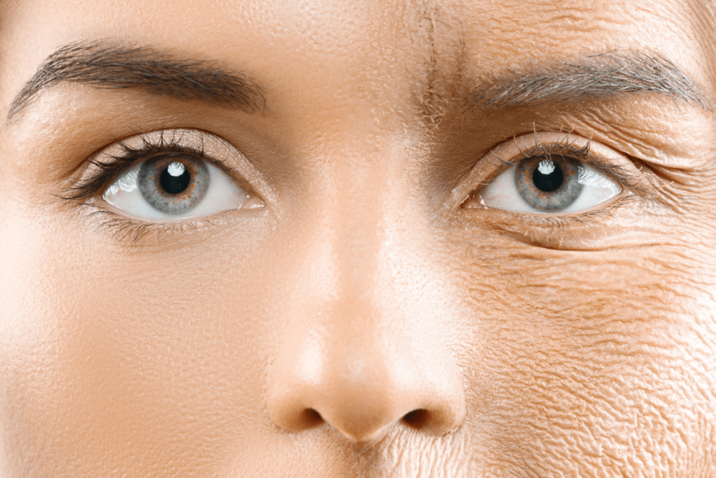 Wrinkle Reduction