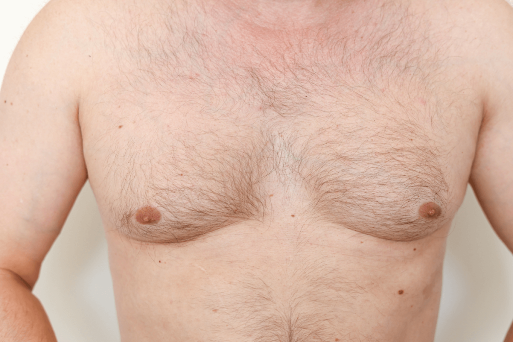 nipple_2